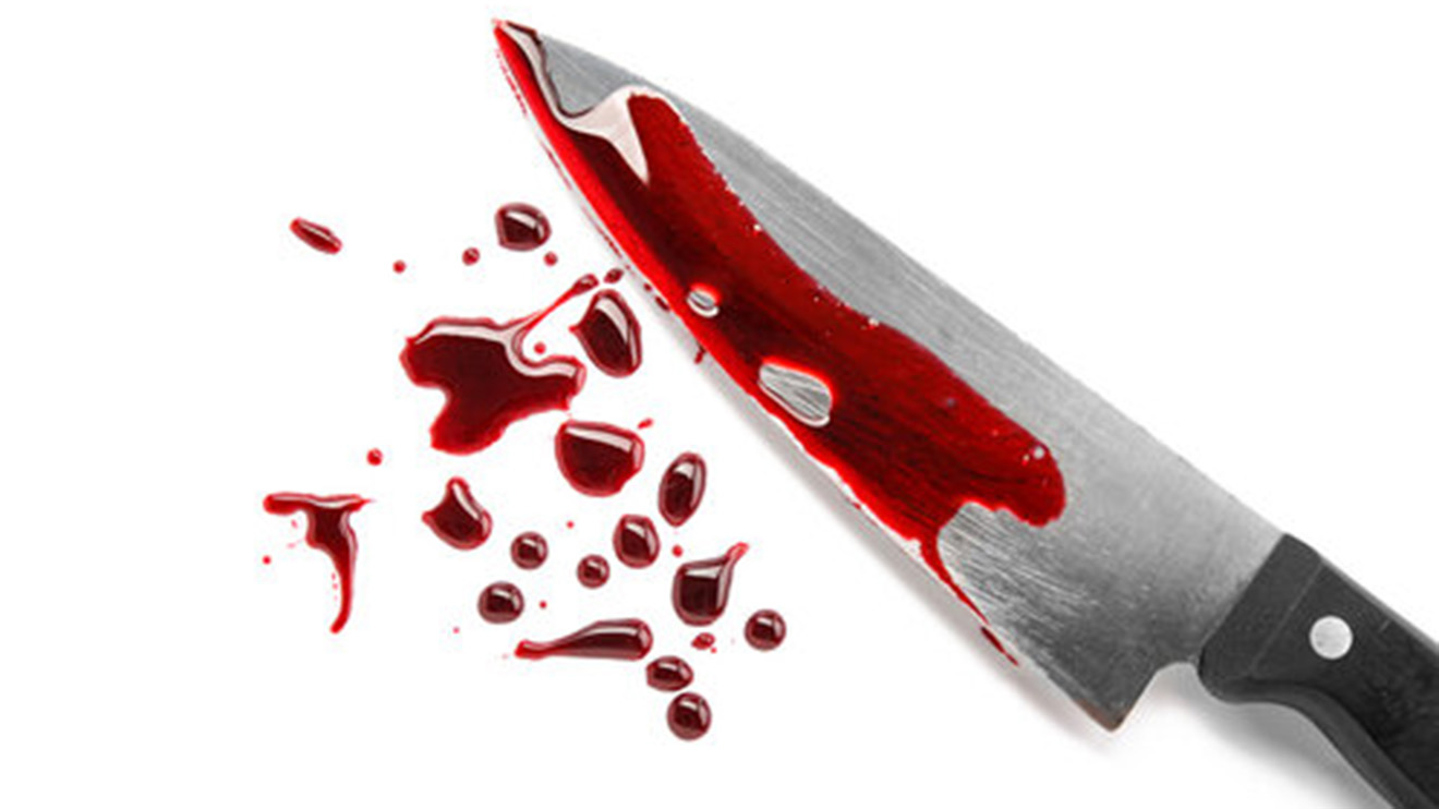 Bloody knife.